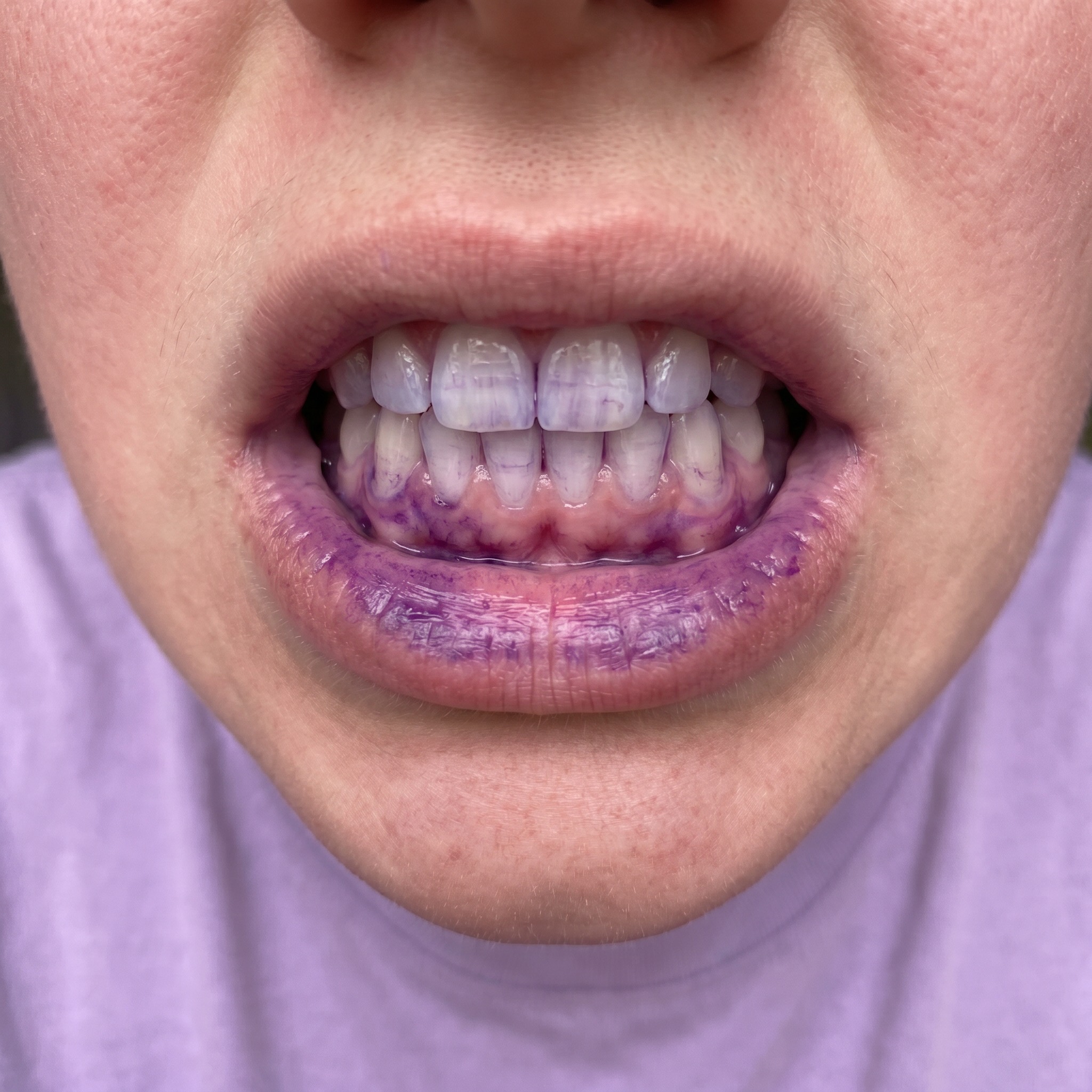 Other purple mouthwashes